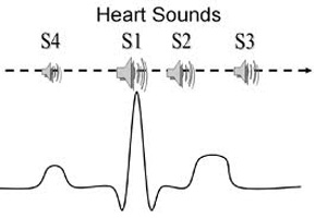 heartsound