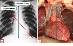Long axis of heart vs. body