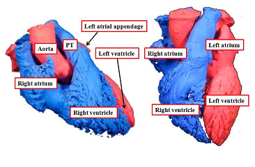 Blood volumes: Attitudinally Correct Versus Valentine