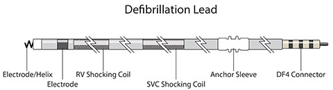 Defib Lead