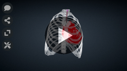 Transesophageal-Echocardiograph-Probe