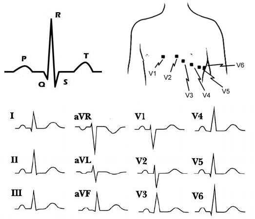 Start Image