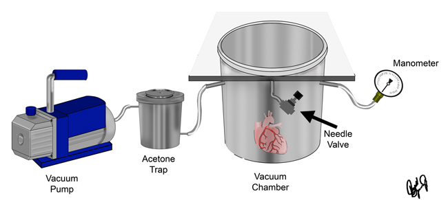 Vacuum system