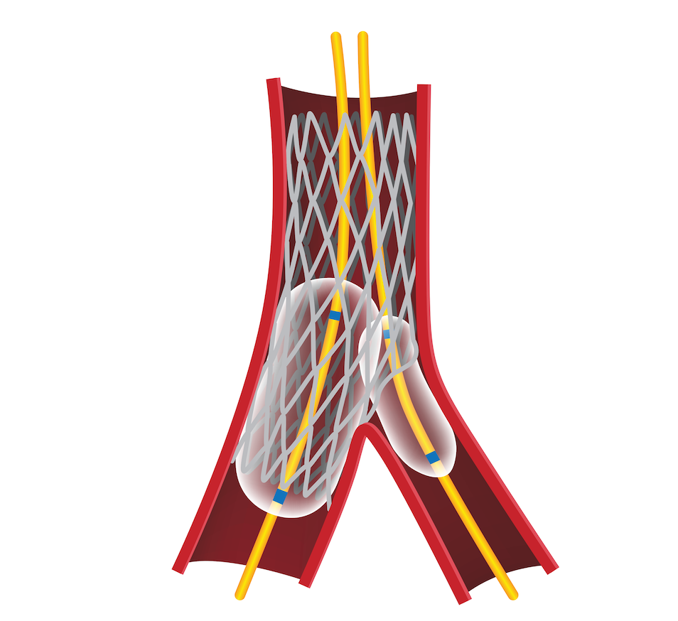 Proximal Optimization Technique